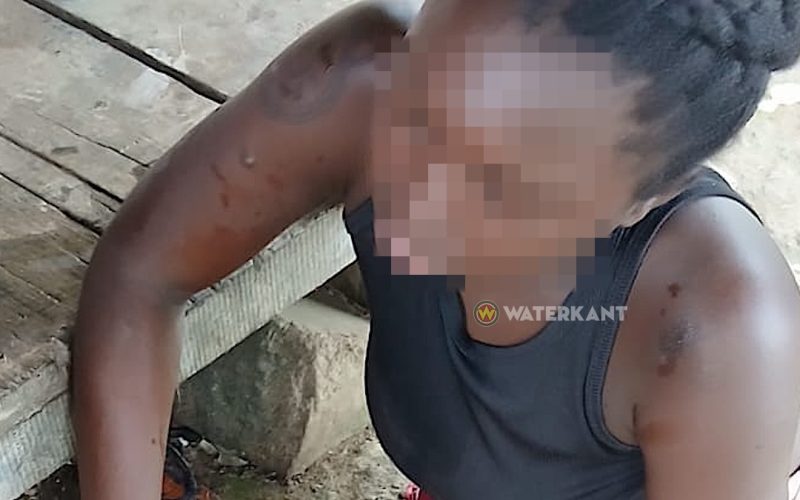 19-jarige zwangere vrouw slikt pesticiden en ontsnapt uit ziekenhuis