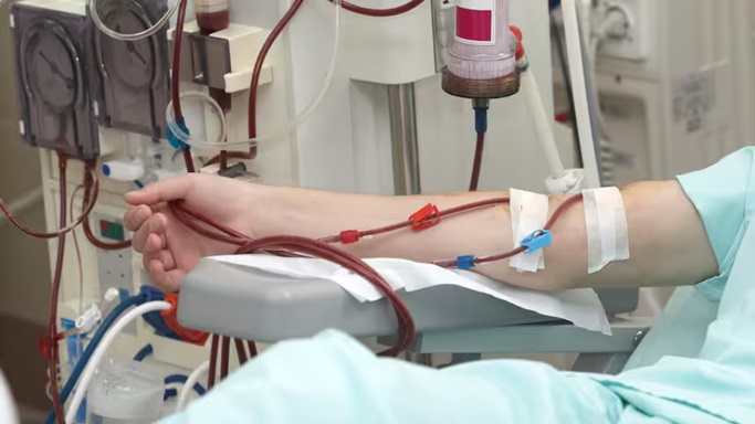 Aantal niertransplantaties in Nederland bereikt hoogtepunt